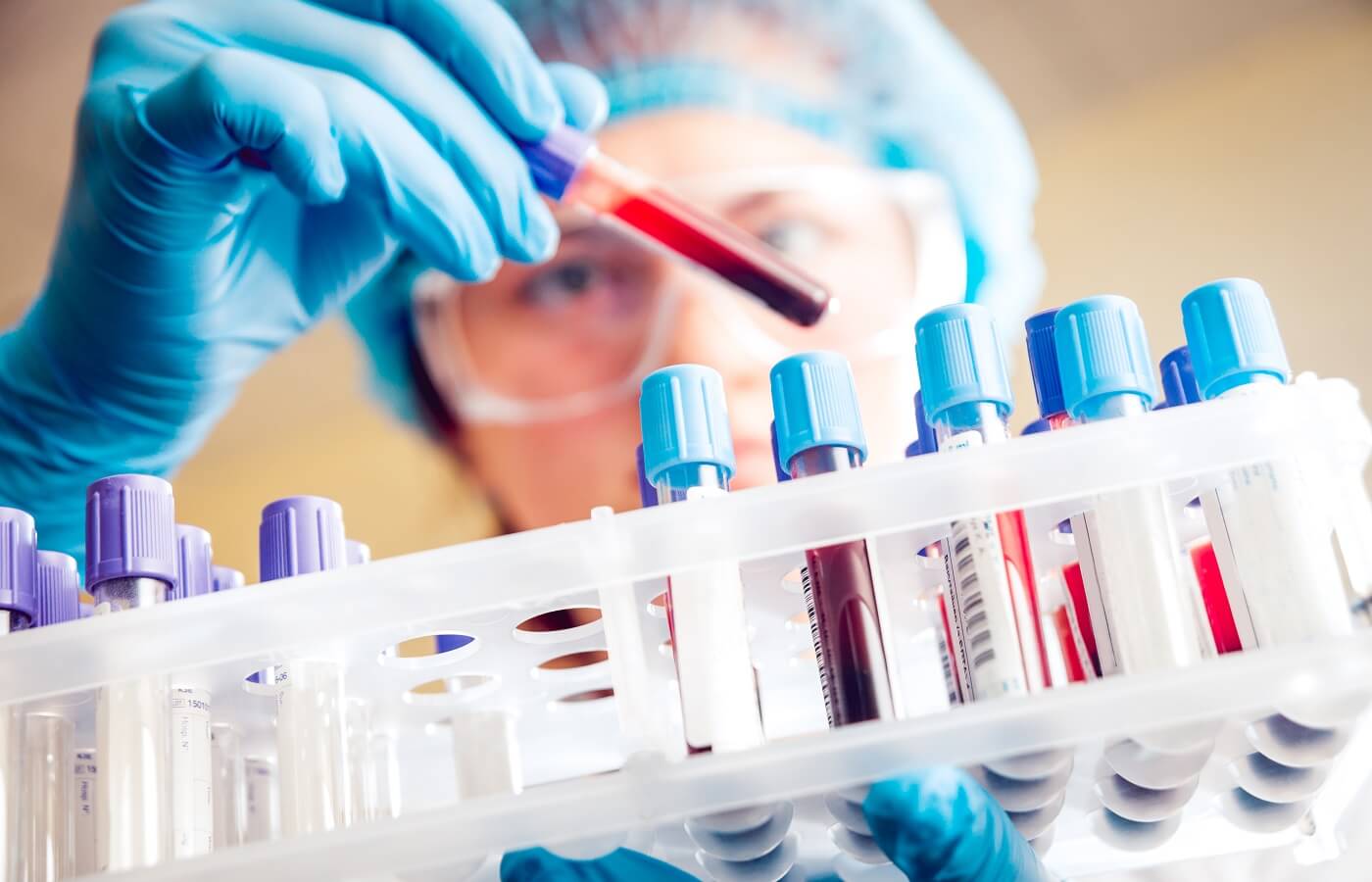 Técnico Superior en Laboratorio Clínico y Biomédico (Pruebas Libres)
